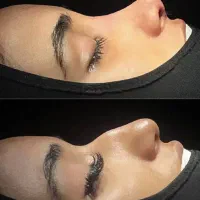 عمل جراحی بینی با ۵۰٪تخفیف ویژه فرصت محدود|خدمات آرایشگری و زیبایی|اصفهان, نقش جهان|دیوار