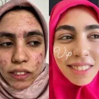 کرم فوق العاده سفید کننده vip