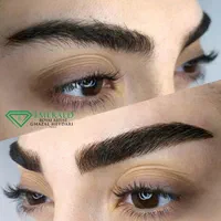مدل برای میکروبلیدینگ