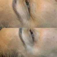 فشیال و پاکسازی پوست تخصصی و کلینیکال|خدمات آرایشگری و زیبایی|سبزوار, ولیعصر (نجار آباد)|دیوار