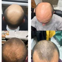مو نکار|آرایشی، بهداشتی، درمانی|اصفهان, جوزدان الیادران|دیوار