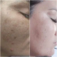 جشنواره تخفیفات پاکسازی و فشیال