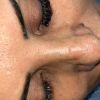 مدل کاشت مژه