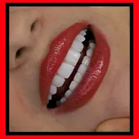 دندانپزشکی کامپوزیت/عصبکشی/ترمیم دندان/روکش بریج|خدمات آرایشگری و زیبایی|تهران, میدان ولیعصر|دیوار