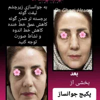 پکیج جوانساز