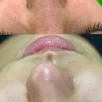 انجام خدمات پاکسازی و فیشیال تخصصی