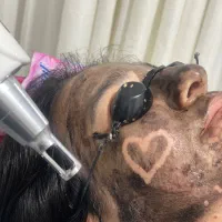 مرکز زیبایی، لیزر، رفع تیرگی،حذف تتو،ژل