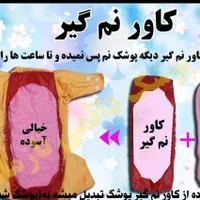 پوشک دائمی|کفش و لباس بچه|امیدیه, |دیوار