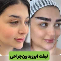 جشنواره تخصصی میکرو‌کاشت ابرو‌در شیراز