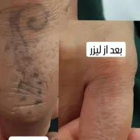 جلسه اول رایگان به مناسبت سالگرد افتتاحیه|خدمات آرایشگری و زیبایی|تبریز, |دیوار