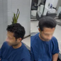 خدمات پروتئین و کراتین مو(مردانه)