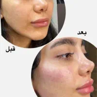 فیلر ژل لب بوتاکس تخصصی پزشک کلینیک تهرانسر|خدمات آرایشگری و زیبایی|اسلام‌شهر, باغ فیض|دیوار