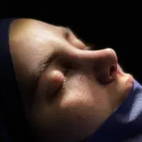 عمل بینی در اهواز|خدمات آرایشگری و زیبایی|اندیکا, |دیوار