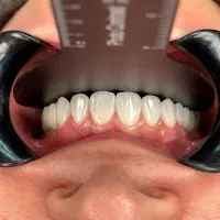 دندانپزشکی|آرایشی، بهداشتی، درمانی|ارومیه, |دیوار