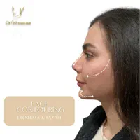 ادیت محتوا اینستاگرام|خدمات رایانه‌ای و موبایل|تهران, چیتگر جنوبی|دیوار