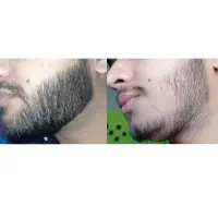 ۱۲ هزار رویش تو چرا ن