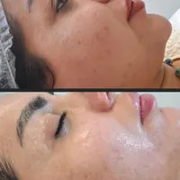فیشال و پاکسازی پوست|خدمات آرایشگری و زیبایی|اصفهان, دشتستان|دیوار