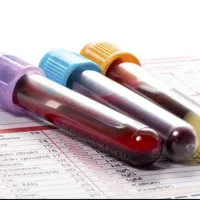 تزریقات. خونگیری. وصل سرم. پانسمان در منزل