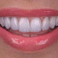 خدمات تخصصی زیبایی دندان