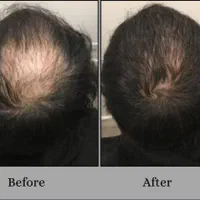 مرکز تخصصی prp نارسیس