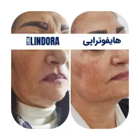 جشنواره عیدانه کلینیک زیبایی لیندورا