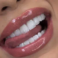 ترمیم عصب کشی روکش کشیدن دندان قسط با کد ملی بی چک|خدمات زیبایی و سلامت|مشهد, هنرستان|دیوار