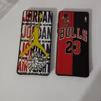 قاب یا گارد گوشی نوت۱۱ شیائومی