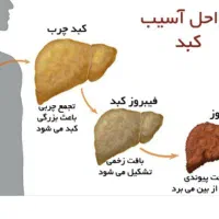 وایتکس کبد روغن معجزه گر