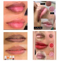 میکروبلیدینگ و میکروپیگمنتیشن و ریموو