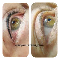 میکروبلیدینگ فیبروز شیدینگ لب خط چشم ریموو|خدمات آرایشگری و زیبایی|تهران, سردارجنگل|دیوار