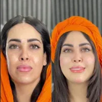 تزریق ژل و فیلر لب،گونه،چانه(جشنواره)درمطب فقط499ت|خدمات آرایشگری و زیبایی|اصفهان, باغ زیار|دیوار