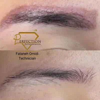 ریموو تخصصی ابرو ،لب ،چشم کاملا تضمینی