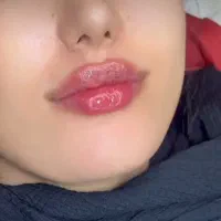 اف ویژه تزریق فیلر و بوتاکس و..در کلینیک توسط پزشک|خدمات زیبایی و سلامت|کرج, گوهردشت|دیوار