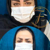 کاشت ابرو تخصصی در درمانگاه کمیل|خدمات آرایشگری و زیبایی|اهواز, زیتون کارمندی|دیوار