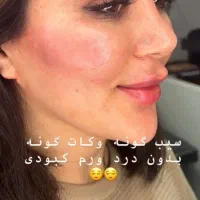 زل صورت|خدمات آرایشگری و زیبایی|بوئین زهرا, |دیوار