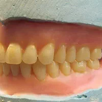 ساخت دندان و دندان سازی قدیری|خدمات آرایشگری و زیبایی|یزد, |دیوار