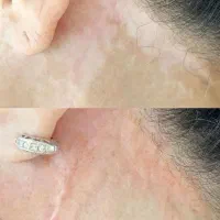 اولین مرکز تخصصی تاتوپزشکی بهشت|خدمات زیبایی و سلامت|تهران, عباسآباد|دیوار