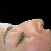 جراحی زیبایی