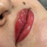 شیدینگ لب.  بن مژه