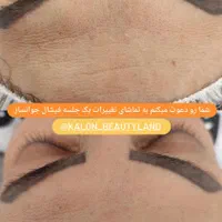 پاکسازی و فیشال آقایان و بانوان توسط پیراپزشک|خدمات آرایشگری و زیبایی|گلبهار, شهر جدید گلبهار|دیوار
