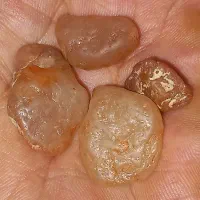 سنگهای مرمرعقیق|کلکسیون اشیاء عتیقه|مشهد, امیریه|دیوار