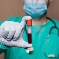 نمونه گیر ک پذیرش آزمایشگاه+استخدام