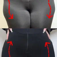 فیلربادی با تخفیف ۵۰٪در کلینیک مهرزاد