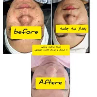 پاکسازی وفیشال تخصصی|خدمات آرایشگری و زیبایی|بومهن, |دیوار