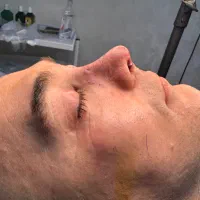 بینی در بیمارستان ۳۰