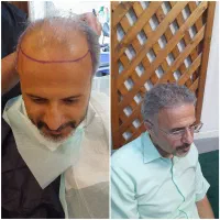 با طاسی خدا حافظی کن