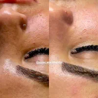 پاکسازی و فیشال پوست در کلینیک زیبایی-آموزش|خدمات آرایشگری و زیبایی|اهواز, کیانپارس |دیوار
