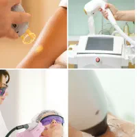 دستگاه لیزر با اپراتور