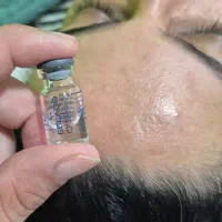 فشیال تخصصی و کلاسیک فقط  با پرداخت هزینه مواد