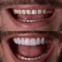 خدمات دندانسازی و دندانپزشکی با تعرفه ویژه|خدمات آرایشگری و زیبایی|شیراز, هفت تنان|دیوار